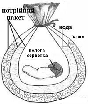 Реферат: Перша допомога при травмах удар, вивих, перелом, розтягнення